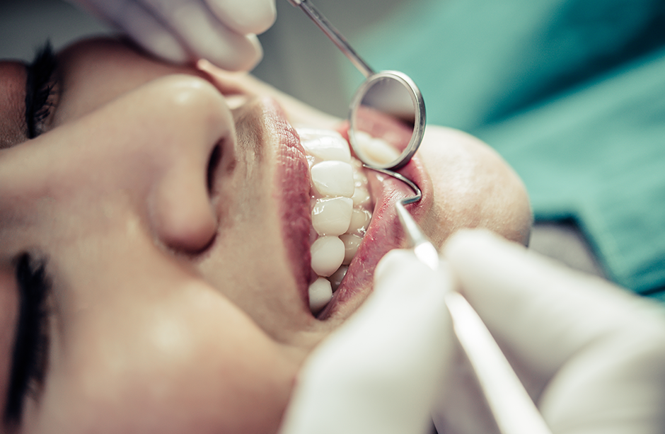 Diş Eti Kanaması (Gingivitis) Nedir? Neden Olur? Nasıl Geçer?